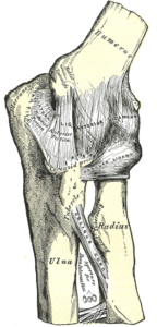 Olecranon bursitt